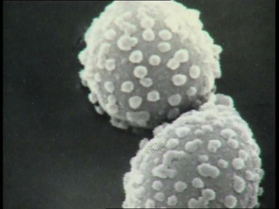 Vision al microscopio electr�nico de unos granos de p�len.  Imagen de sciencepics.org con licencia Creative Commons